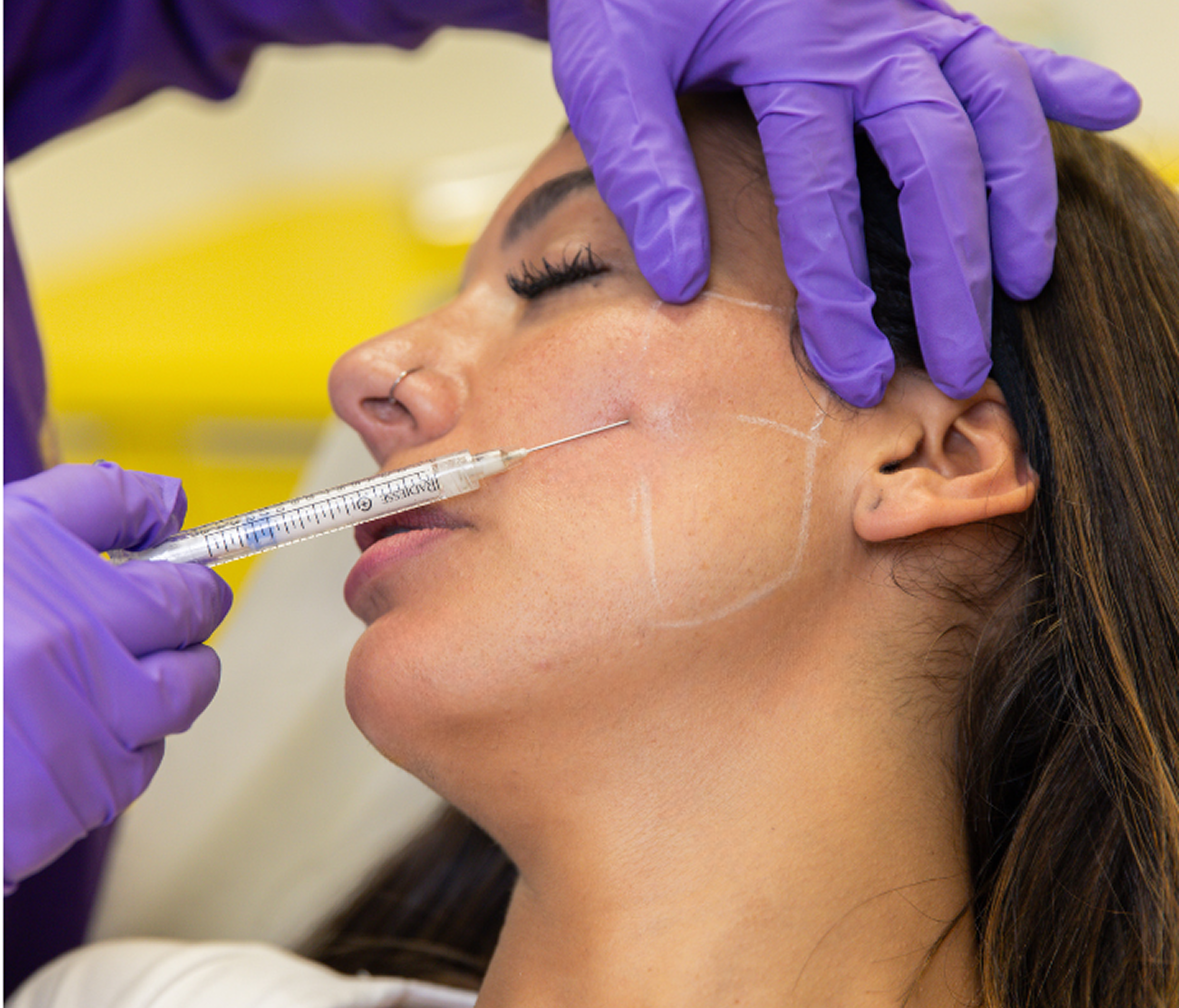 Formation complète Injecteur Confiant